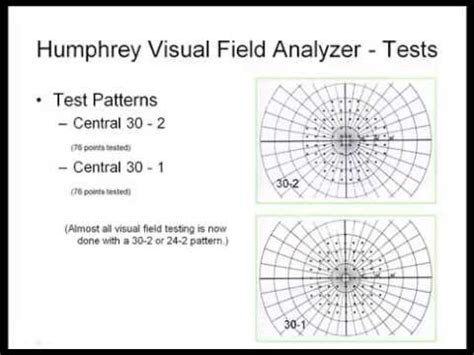 Visual Field Chart Interpretation: A Visual Reference of Charts | Chart ...