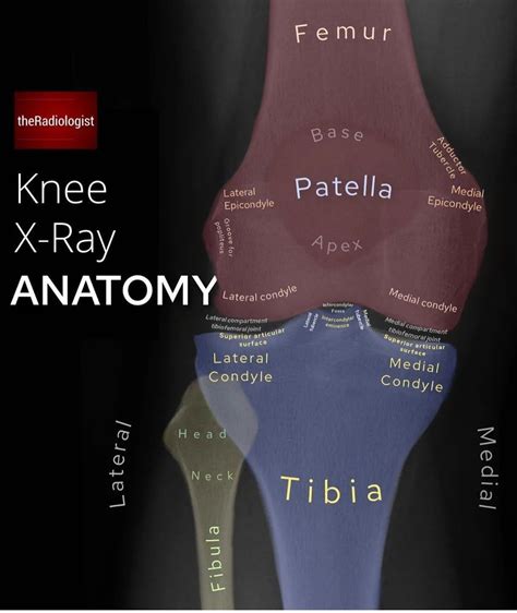 Knee X-ray Anatomy - MEDizzy