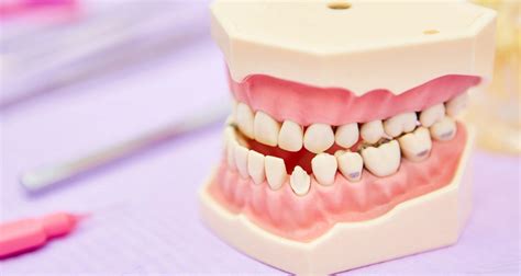 treatments  malocclusion  highly effective options