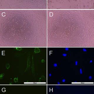 Effects Of Galectin On The Morphology Of Cultured Human Retinal