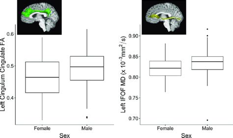 Sex Differences On White Matter Microstructure Of Examined Tracts After