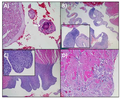 Representative Images Of Histopathological Features Found In The Heart