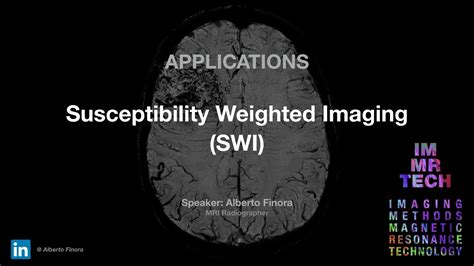 Susceptibility Weighted Imaging Swi Youtube