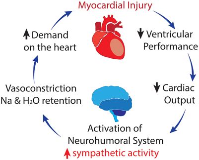 Vicious Cycle Of Heart Failure Where Activation Of The Sympathetic And