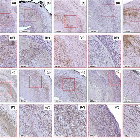 Expression Of Macrophage Phenotypic Markers Proinflammatory Cytokines