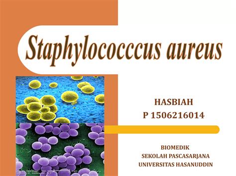 Staphylococcus Aureus Ppt