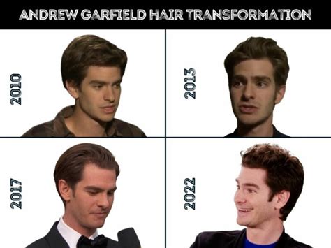 Andrew Garfield Hair Transplant Hair Loss And Technical Analysis