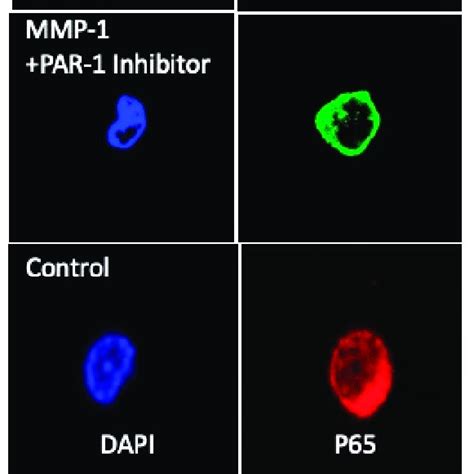 Confocal Images Of TET2 And P65 Immuno Fluorescence Staining In