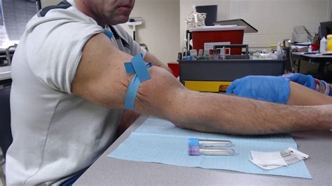 practices straight needle venipuncture youtube