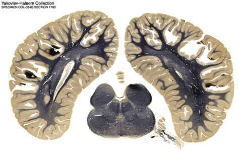 The Dolphin Brain Atlas at Michigan State University