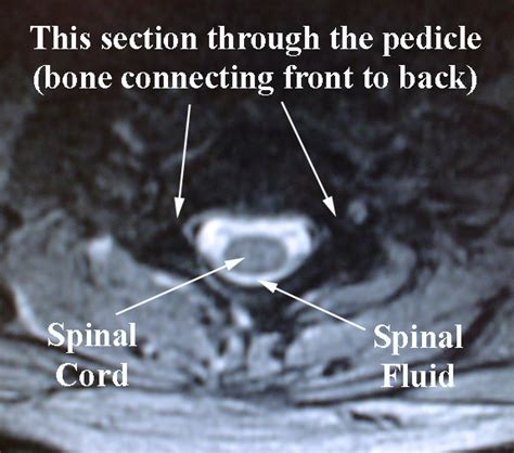 Cervical Anatomy Drwolgin