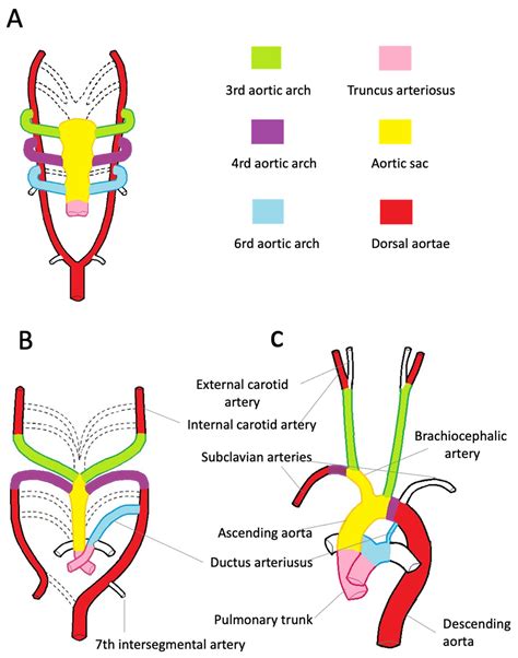 Diagnostics Free Full Text Thoracic Aorta Anatomy And Pathology