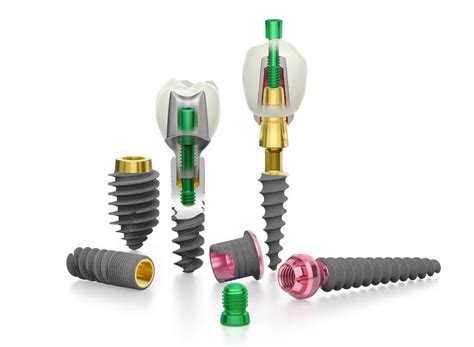 The Comprehensive Guide On Two Piece Compressive Screw And Basal Implants