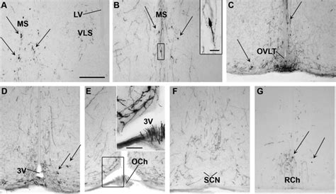 GnRH 1 Immunoreactivity In Representative Naked Mole Rat Median