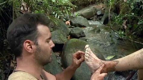 Naked And Afraid On Twitter Trench Foot Is A Condition That Can Affect Anyone Who Is Exposed