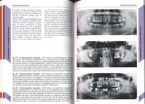 Solution Parodontopathies Et Pathologie Inflammatoire P Studypool