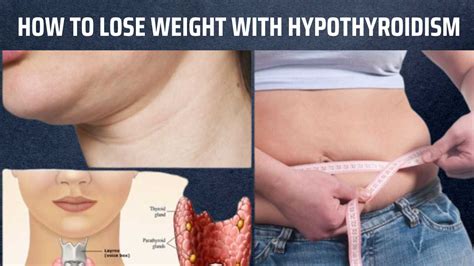 Thyroid Troubles Heres How To Lose Weight With Hypothyroidism