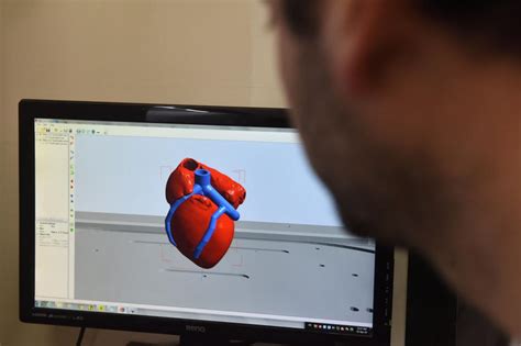 The Very First 3d Printed Vascularized Heart Has Been Created