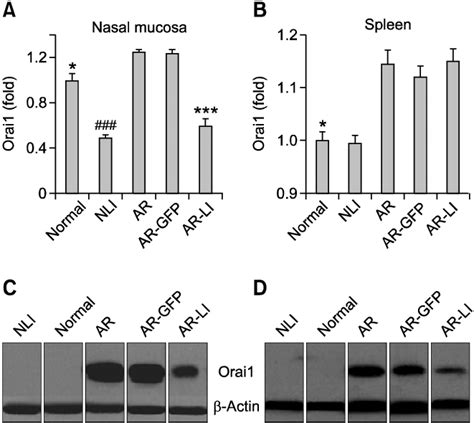 The Mrna And Protein Expression Of Orai Orai Transcript Levels In