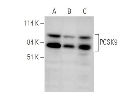 PCSK9 Antibody F 8 SCBT Santa Cruz Biotechnology