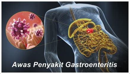 Penyakit Gastroenteritis Perumperindo Co Id