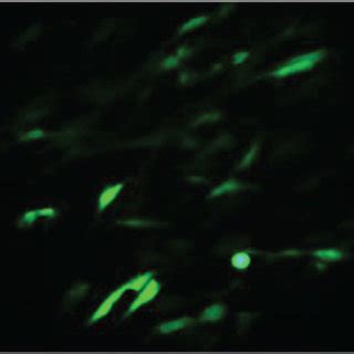 The Cell Morphology Was Significantly Impaired Under High Glucose And