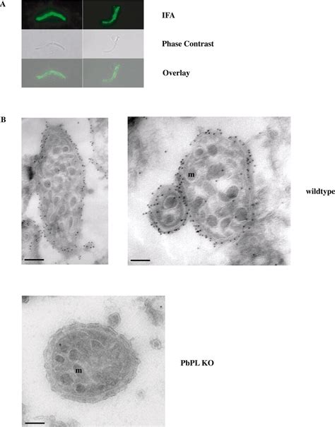 A Surface Phospholipase Is Involved In The Migration Of Plasmodium