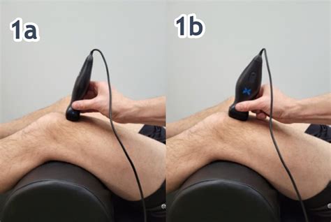 The Use Of Msk Ultrasound With Quadriceps Muscle Injury Published In