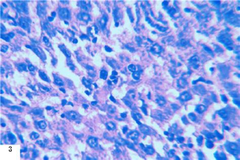 Liver Section Of Normal Control Rat Showing Hepatic Cells With Nuclei