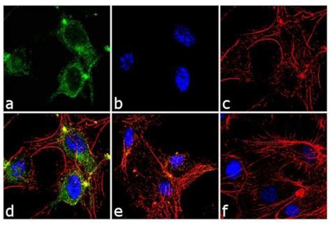 Anti Angiopoietin Like Angptl Antibody Rp Ab Abcam