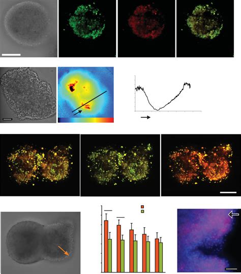 Analysis Of Oxygenation Of Neurospheres Using Mm Probe A Multiphoton