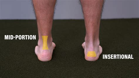 Achilles Tendinopathy - E3 Rehab