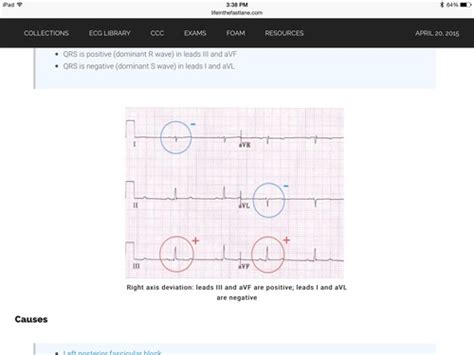 Endocrine Flashcards | Quizlet 