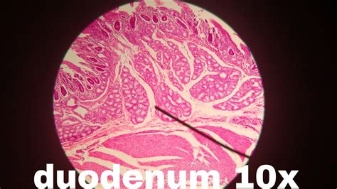 Duodenum Histology Labeled