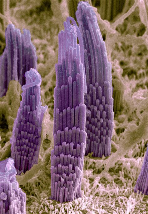 Human Ear Hair Cell SEM Stock Image C048 9381 Science Photo Library