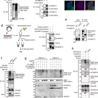 Gal Degrades Hbc Via P Mediated Selective Autophagy A Gal Interacts