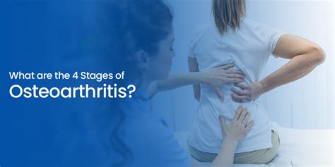 9 Unusual Symptoms Of Rheumatoid Arthritis Revealed