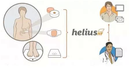 Proteus Digital Health可吞服的数字药丸监测身体数据 MedSci cn