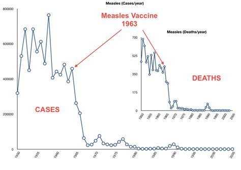 Measles Losing In The Lucky Country