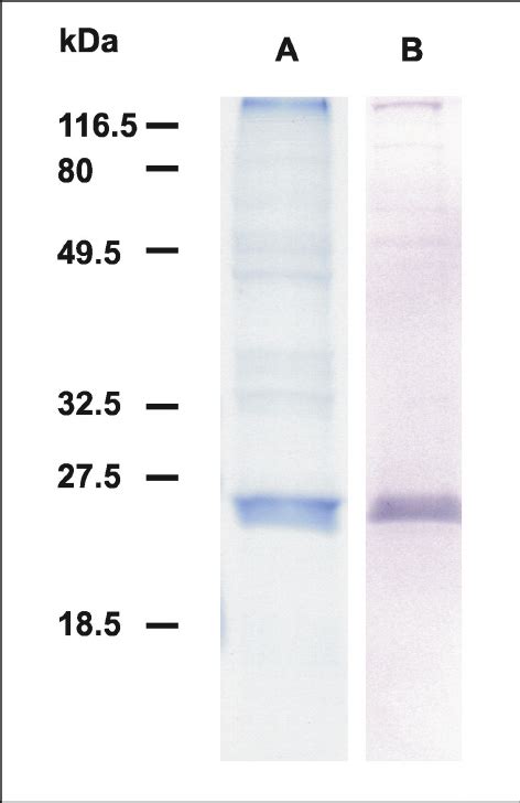 Coomassie Brillant Blue R Stained A And Western Blotted B