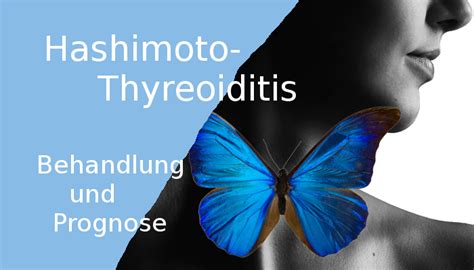 Hashimoto Thyreoiditis