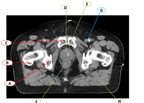 Ct Pelvis Male 1 Diagram Quizlet