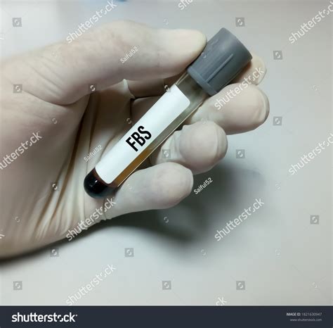 Technician Scientist Hold Sample Tube Plasma Stock Photo 1821630947