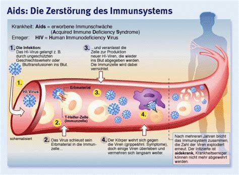 Bilderstrecke Zu Reportage Drei Generationen Aids Bild 2 Von 2 Faz