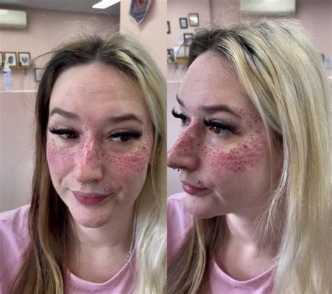 Tattoo Artist Shows Off Freckles She Inked On A Client But People Are Horrified Hrtwarming