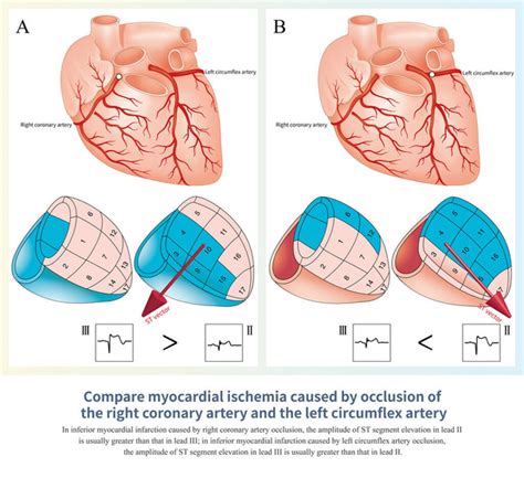 Images Pour Cardiac Conduction System Photos Et Images Pour Cardiac