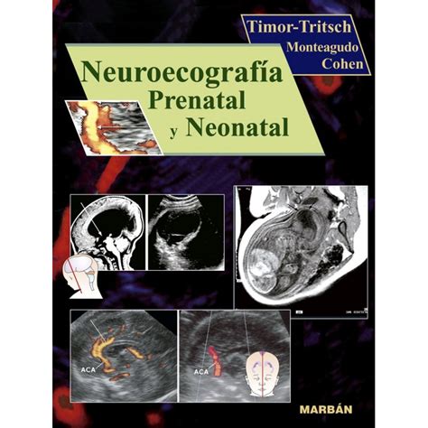 Neuroecografía Prenatal Y Neonatal Marbán Internacional