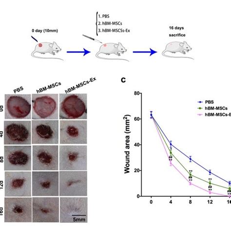 HBM MSCs Ex Enhanced The Cutaneous Wound Healing Quality A The