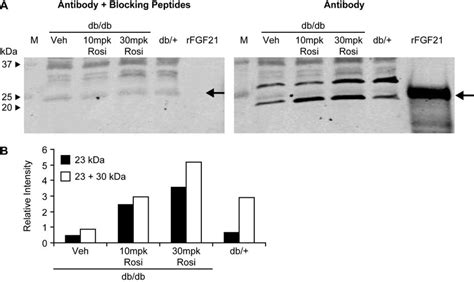 Plasma FGF21 From Db Db Mice Is Up Regulated By The PPAR Agonist