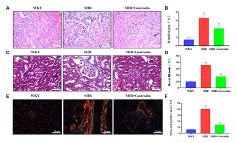 Figure 1 From Gastrodin Attenuates Renal Injury And Collagen Deposition